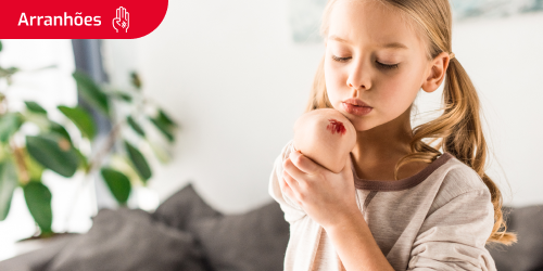 Imagem de uma rapariga com um arranhão no cotovelo Imagem de uma rapariga com um arranhão no cotovelo